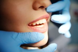 White Fillings Sherwood Park